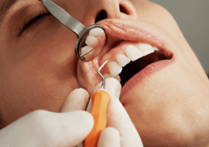 Person during dental hygienist appointment at Crescent Lodge Dental Practice in Clapham