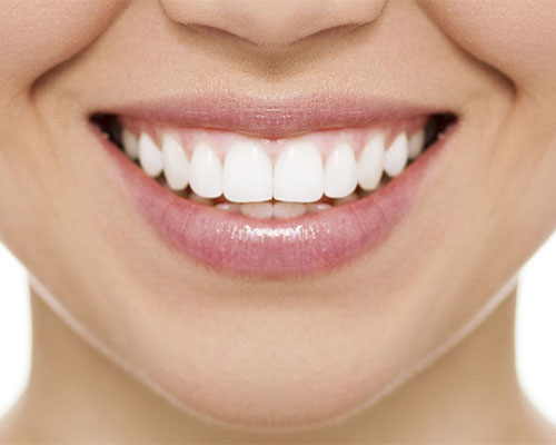 Close up of teeth whitening client at Clapham dental practice in London