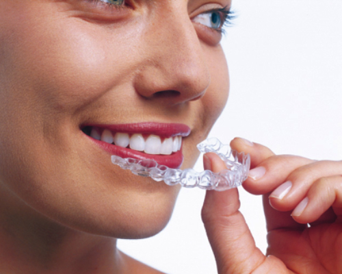 Invisalign Clear Braces in Clapham Common, London