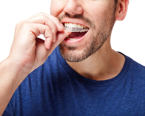 How Can I Straighten My Teeth Discreetly In South West London?