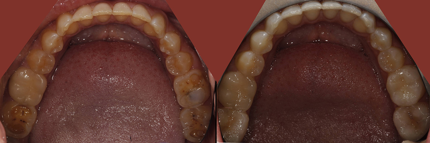 image of teeth before treatment