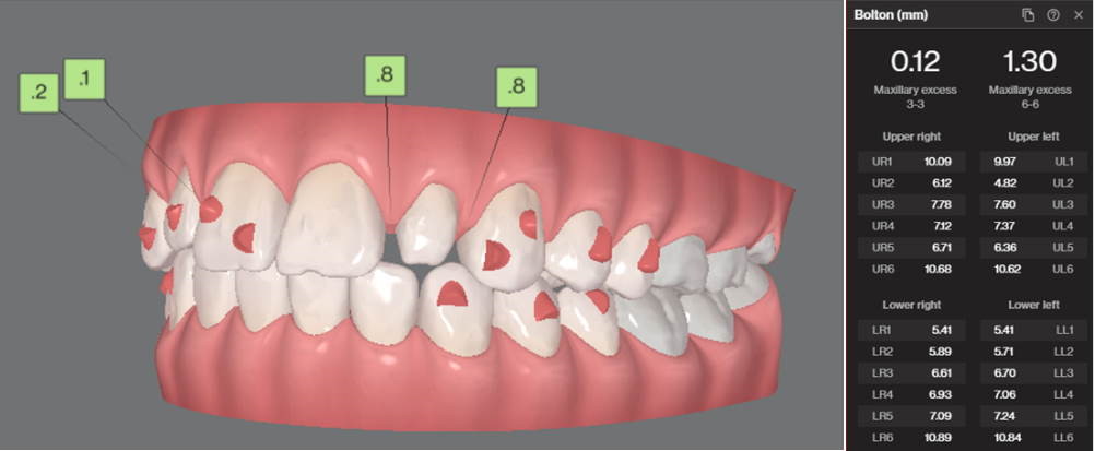 An image showing a digital plan of how they will make the teeth better.