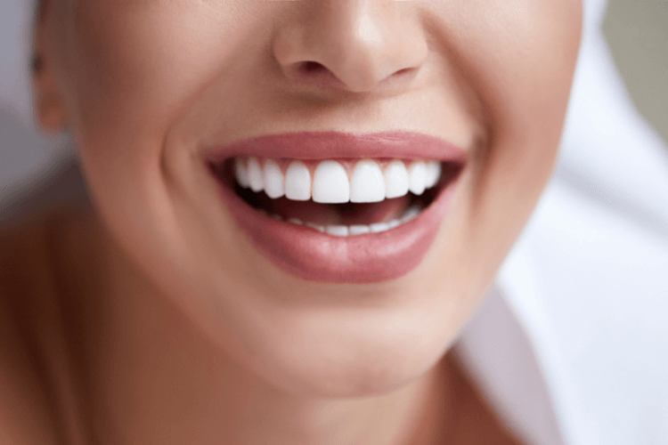 Woman smiling after getting dental implants