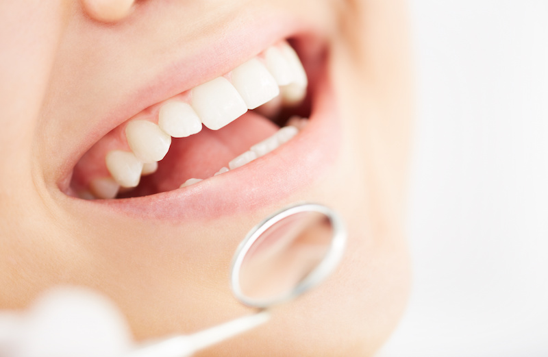 Person smiling after dental implant